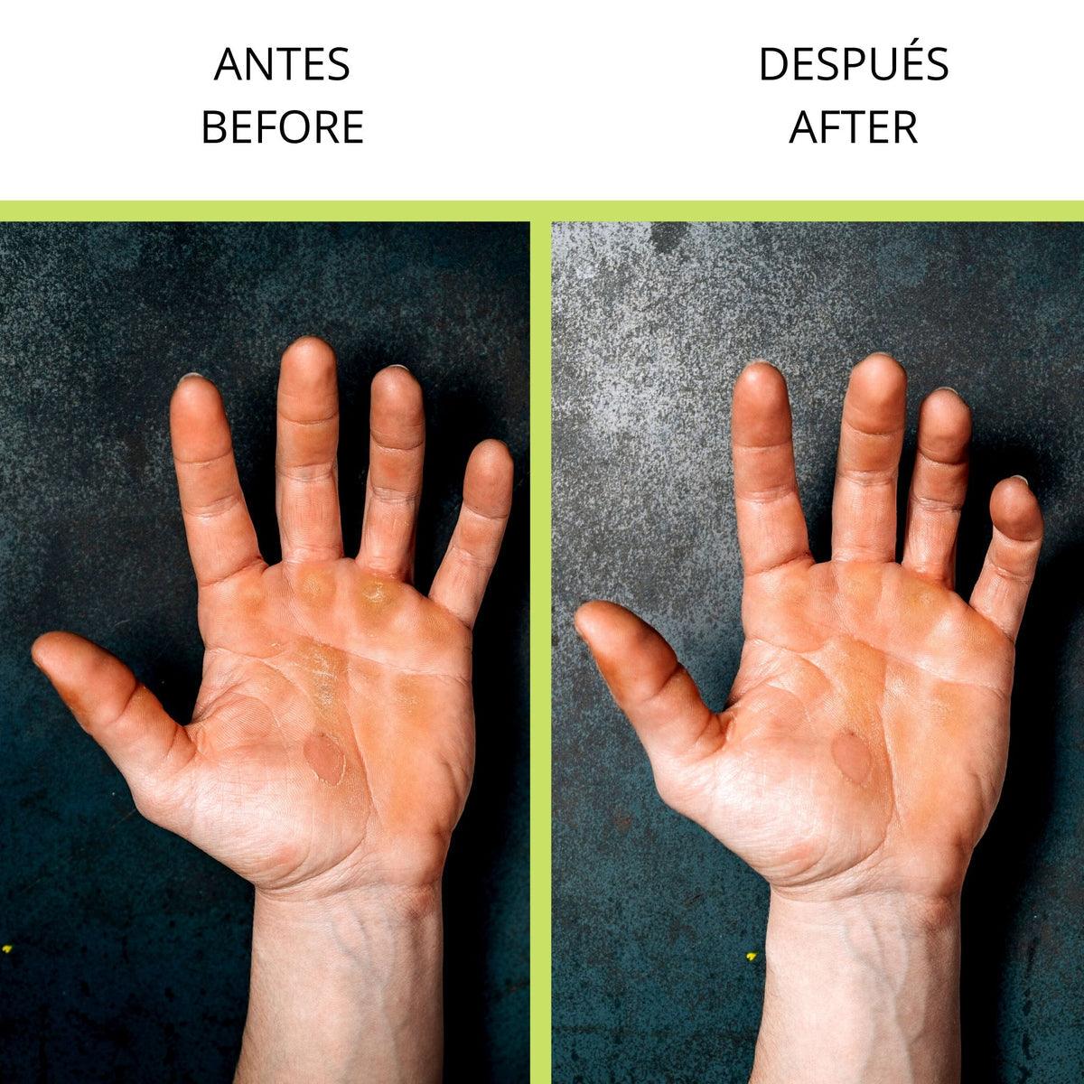 Limacallos Velites - Unbroken Fitness Shop